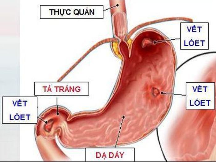 Ngoài ra, bạn cũng có thể lấy xương mèo ngâm rượu uống chữa đau nhức xương rất tốt.
