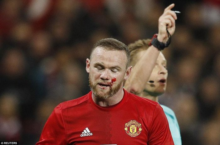 Thủ quân Wayne Rooney đổ máu sau một pha tranh chấp với hậu vệ đội khách. 