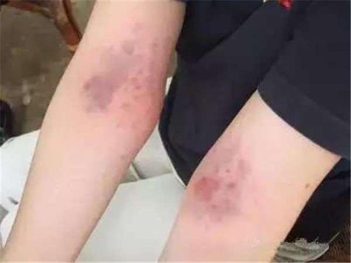 Duy trì cách vỗ này liên tiếp sẽ giúp cơ thể được thanh lọc, khỏe mạnh, độc tố sẽ tiêu tan dễ dàng.