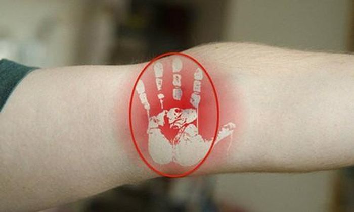  Cách trừ độc ở khuỷu tay: Cách trừ độc ở vùng khuỷu tay cực kỳ đơn giản. Bạn chỉ cần hơi khum bàn tay sau đó lần lươt vỗ, tác động vào vùng khuỷu tay mỗi bên khoảng 10 phút là có kết quả tốt.
