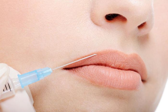 Ăn kiêng là điều bắt buộc với tất cả mọi người phải thực hiện sau khi thực hiện xong quy trình phun xăm thẩm mỹ (Ảnh minh họa)