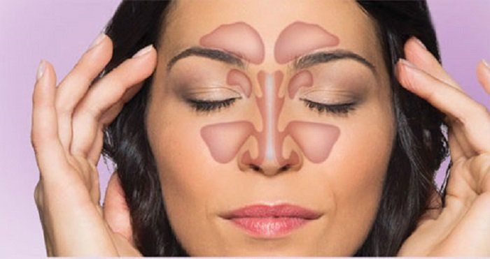 Bệnh xoang thường gây nên chứng đau đầu 