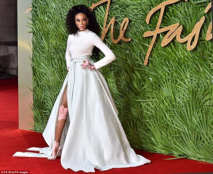 Người mẫu bạch biến Winnie Harlow kết hợp chân váy xẻ cao với áo len trắng đơn giản. Cô là một trong những gương mặt hiếm hoi thành công sau khi bước ra từ cuộc thi America's Next Top Model. 