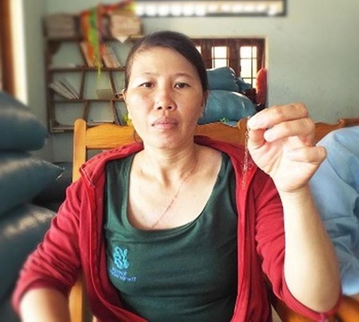 Ngoài vết sẹo dài trên cổ và thủng màng nhĩ, dây chuyền chị Hạnh cũng cháy đen sau vụ sét đánh kinh hoàng 
