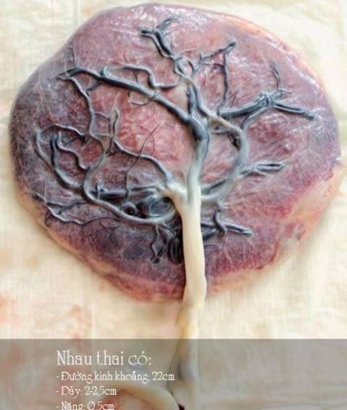 Theo quy định của Bộ Y tế Việt Nam, nhau thai người cần phải được xử lý thật chặt chẽ như là chất thải trong nhóm chất thải y tế lây nhiễm cần đưa đi tiêu hủy. 