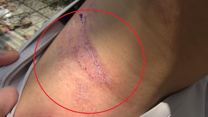Nhiều sinh viên khu ký túc xá Đại học Quốc gia TPHCM "than trời" vì kiến ba khoang. Ảnh: TRÍ NHÂN
