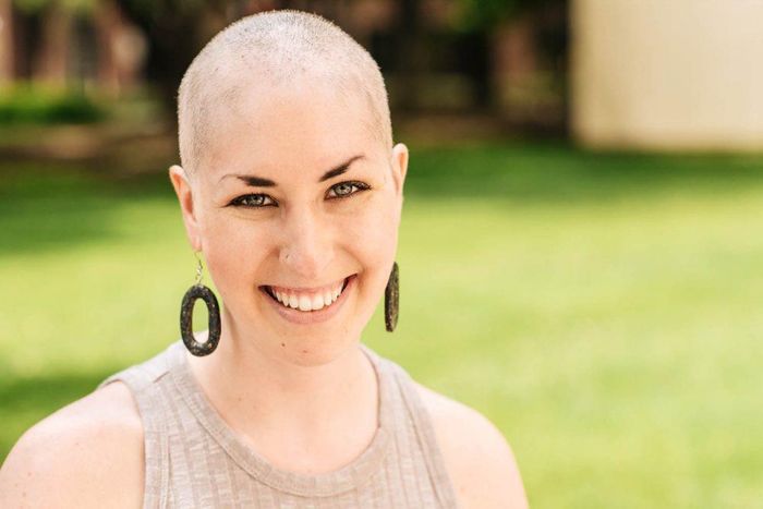 Katie Koppel bắt đầu nhổ tóc từ khi cô 8 tuổi. Ảnh: Wbur.