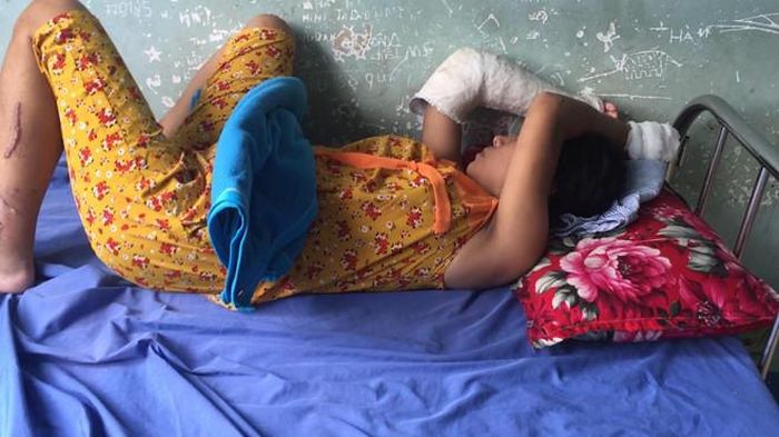 Chị Mến đang mang thai bị đánh gãy tay chân. Ảnh: Tuấn Kiệt.