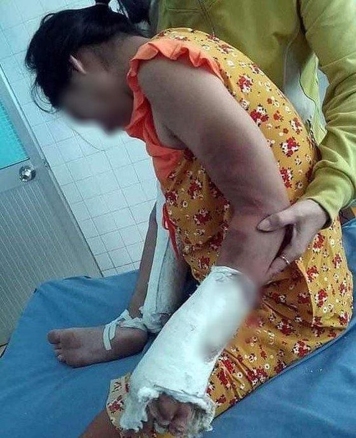 Chị Mến thường xuyên bị chồng đánh đập tàn nhẫn. Ảnh: báo Tổ Quốc