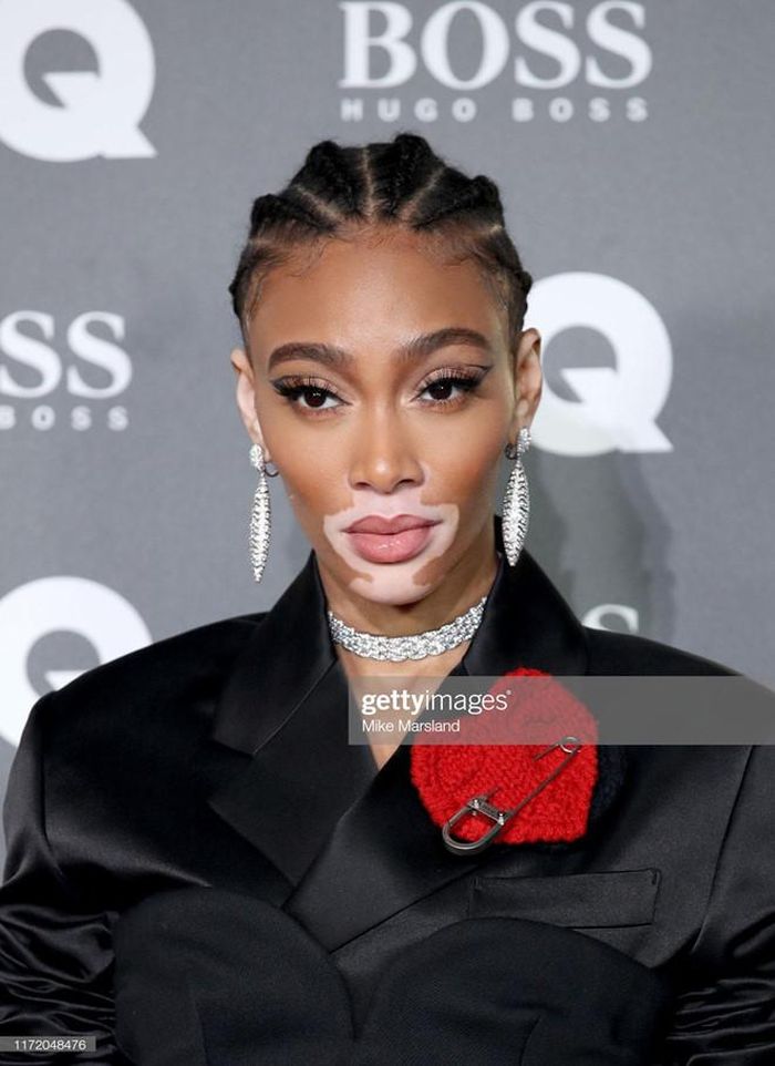 Người mẫu bạch biến Winnie Harlow chọn suit nhấn nhá họa tiết trái tim trên ngực áo, tết tóc cầu kỳ. Cô được nhiều người biết đến khi gia nhập hàng ngũ của Victoria's Secret.