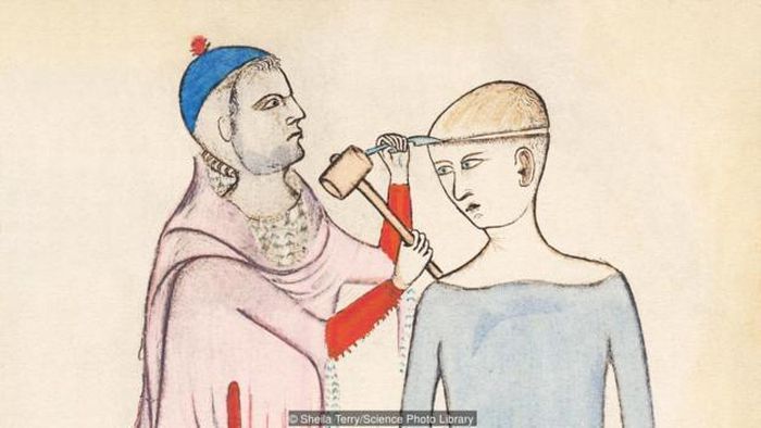 Một bức tranh vẽ vào thế kỷ 14 của họa sĩ Guido da Vigevano. Ảnh: Science Photo Library.