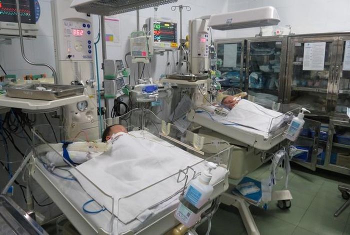Hai bé được chăm tại phòng hồi sức sau ca mổ tách rời. Ảnh: BVCC.