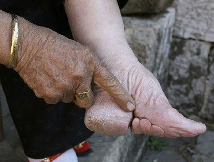 Để có được đôi gót nhỏ nhắn mà người xưa đặt cho cái tên mỹ miều là “gót hoa”, những người lớn trong gia đình sẽ bắt đầu dùng băng vải để bó chân cho con gái, cháu gái họ từ khi mới chỉ 2-5 tuổi, vì khi đó xương bàn chân chưa phát triển hoàn thiện và dễ uốn nắn. Người xưa còn đánh thật mạnh vào lòng bàn chân của các bé gái để các xương vỡ nát cho dễ bó. Khi vải được quấn lại, cô gái bị buộc phải đi lại trên nền nhà để bàn chân biến dạng hơn nữa trong suốt 2 năm