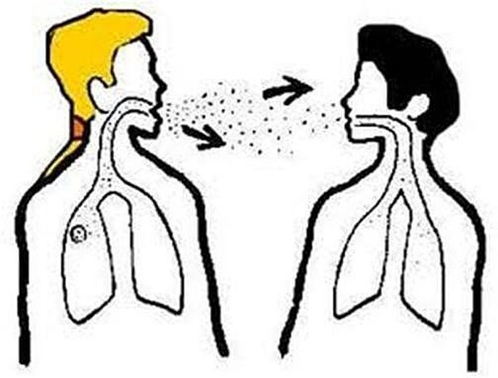  Bệnh lao phổi có lây nhiễm từ người này sang người khác