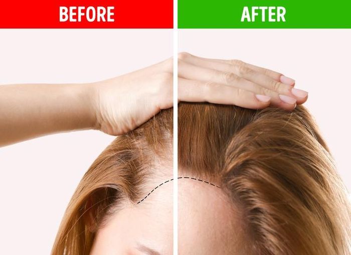 Ăn nhiều rau, trái cây và protein: Nếu bạn muốn tóc chắc khỏe và mọc dày, hãy ăn nhiều rau xanh và trái cây trong chế độ ăn uống. Tóc của chúng ta cần sắt, biotin và vitamin để phát triển khỏe mạnh. Các loại rau như cải bó xôi và đậu, có nhiều chất sắt và trái cây cũng là nguồn cung cấp vitamin tuyệt vời. Ngoài ra, chuối, đậu phộng và súp lơ có chứa biotin tốt cho tóc.