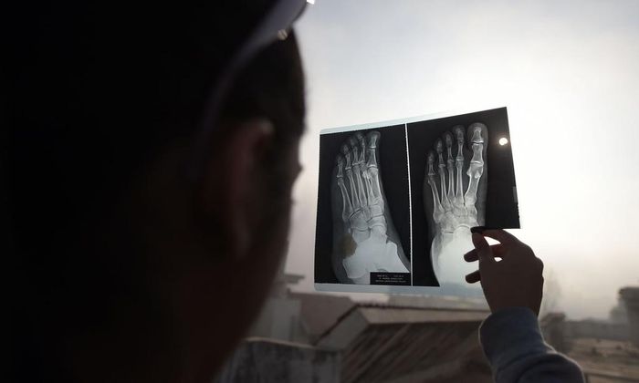  Một bé gái sử dụng tấm giấy chụp x quang như một tấm lọc để quan sát hiện tượng nhật thực. Ảnh: Getty. 