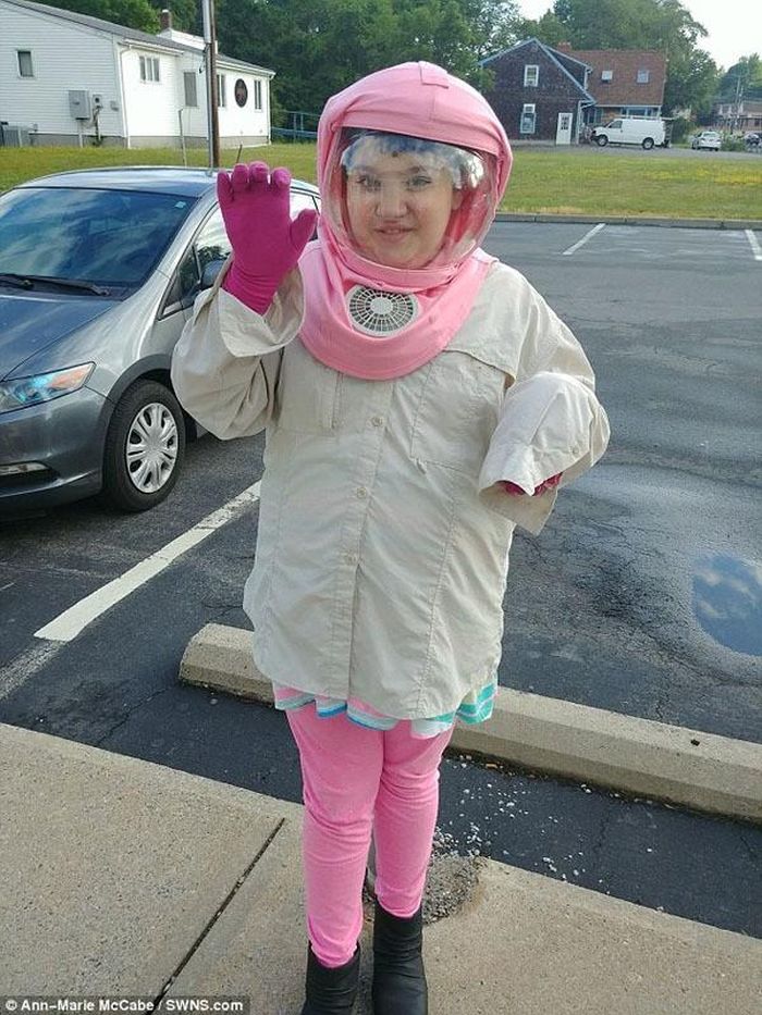 Cô bé Caitlin McCabe, 9 tuổi, đến từ Massachusetts, Mỹ. Từ khi sinh ra, em luôn phải sống cùng chiếc mũ bảo hiểm và quần áo bảo vệ cơ thể suốt cuộc đời còn lại.