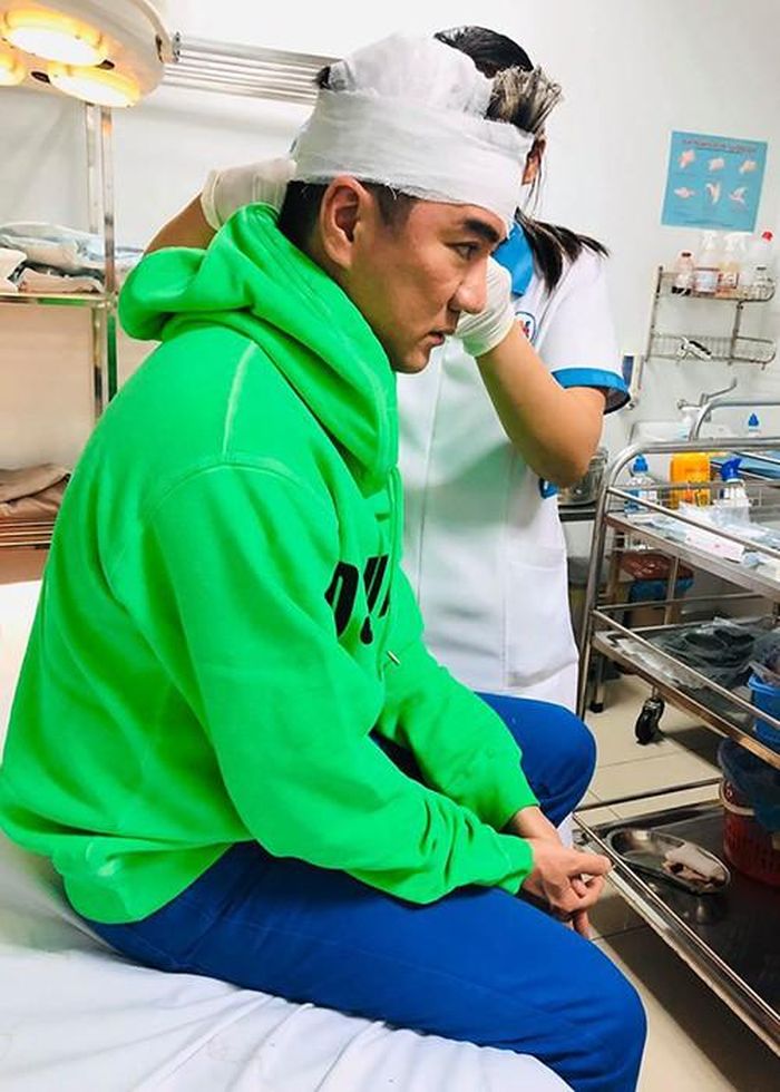 "Tôi không hiểu họ trang trí theo trường phái gì, nhìn chẳng ra sao, trông chỉ giống một cỗ máy đồng hồ cũ kỹ với các bánh răng treo lơ lửng, thấp lè tè ngay trên đầu. Ca sĩ, vũ công hay MC muốn lên sân khấu phải chui qua cái mô hình nhìn như máy chém này. Tôi xui xẻo nên bị thương, máu cứ thế tuôn ra", nam ca sĩ chia sẻ lại sự việc.