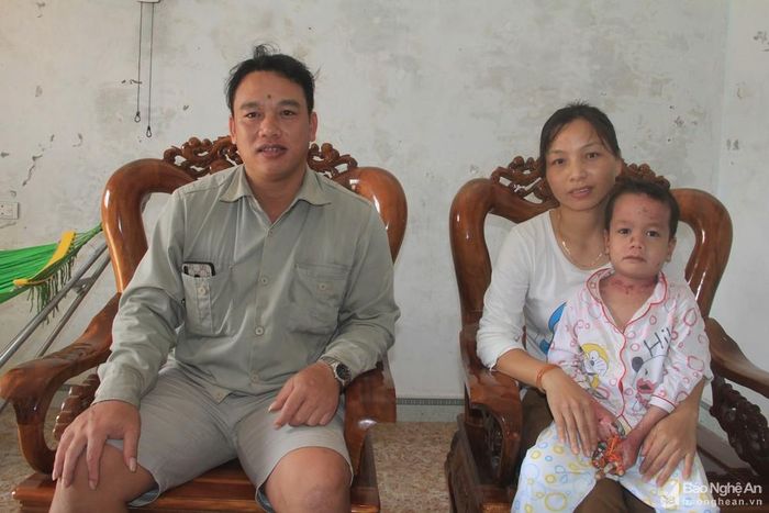 Vợ chồng anh Quyết cùng với đứa con thứ 2 bị bệnh bệnh ly thượng bì bẩm sinh. Ảnh: P.B