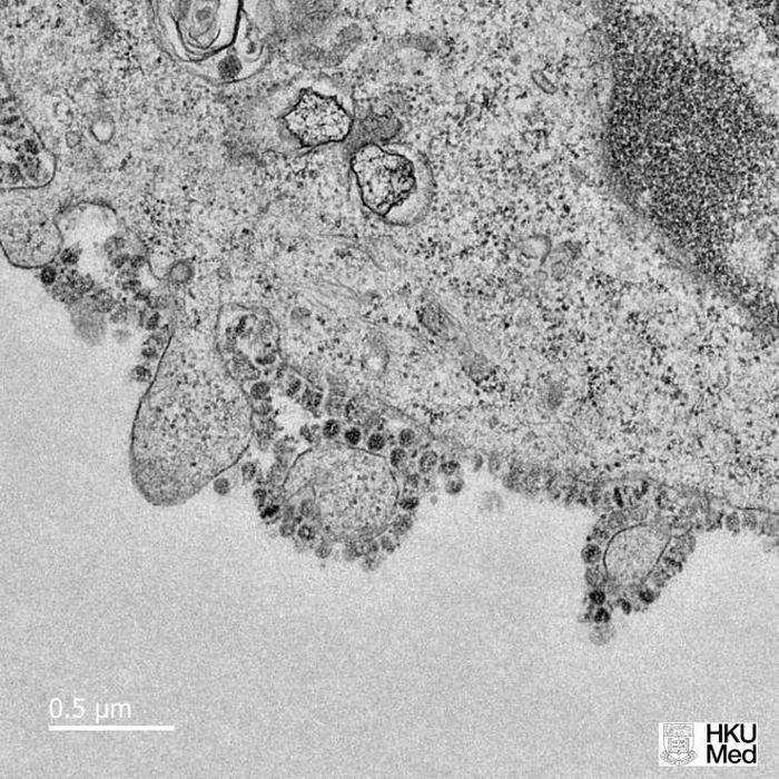 Hiện vẫn chưa tìm ra vaccine cho loại virus này nhưng các nhà khoa học đang thực hiện những bước cơ bản để tiến tới mục tiêu trên. (Ảnh: Đại học Hong Kong)