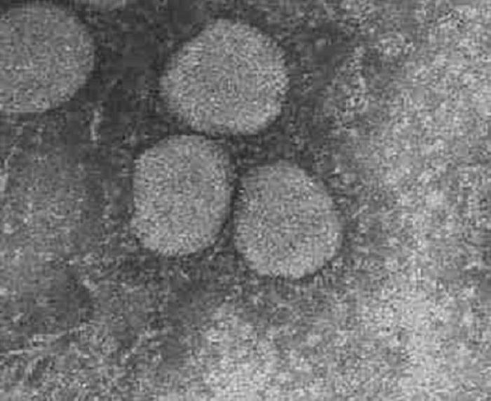 Các nhà nghiên cứu Hong Kong tuần trước tuyên bố tìm ra vacine cho virus corona. Tuy nhiên, họ thừa nhận cần thời gian thử nghiệm và có thể sẽ phải mất ít nhất là vài tháng trước khi đưa loại virus này vào sử dụng lâm sàng. Mặc dù vậy đây mới chỉ là tuyên bố đưa ra từ phía Hong Kong và chưa được cộng đồng khoa học thừa nhận. (Ảnh: WHO)