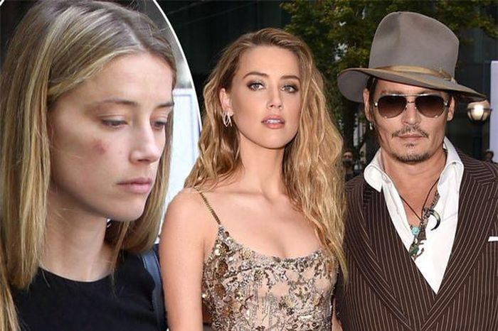 Amber với gương mặt bầm tím ghi mang đơn xin ly hôn Johnny đến tòa án vào năm 2016. (Ảnh: Mirror)