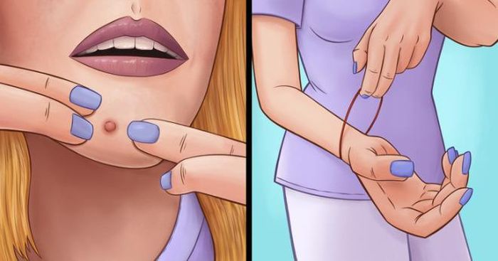 Nặn mụn: Theo các chuyên gia, một số mụn trứng cá có liên kết trực tiếp đến não thông qua hệ thống thần kinh. Nếu bạn bị nhiễm trùng khi nặn mụn sẽ gây ra biến chứng nguy hiểm khác như tê liệt thị lực, viêm màng não, trường hợp xấu nhất có thể thiệt mạng.