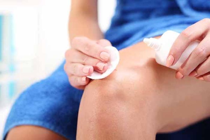 Sử dụng sản phẩm dưỡng ẩm và bảo vệ da.