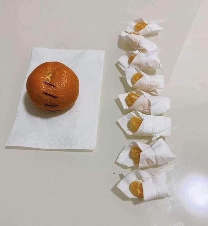 Một ca phẫu thuật thành công khác được dân tình chúc mừng không ngớt trên mạng xã hội. (Ảnh: FB P.T) 