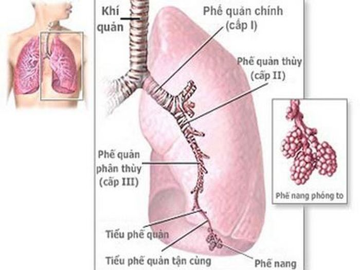 Viêm phế quản dễ gặp vào mùa đông - xuân.