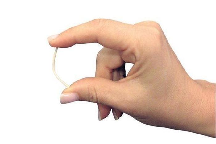 Cấy que tránh thai là biện pháp có nhiều ưu điểm vượt trội so với những biện pháp tránh thai khác (Ảnh minh họa)