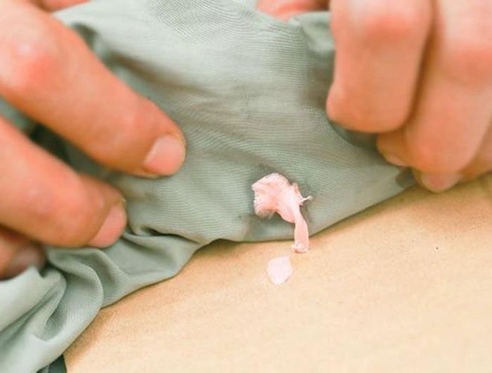  Những vết bã kẹo cao su vô tình dính vào quần áo có thể làm chúng ta lúng túng 