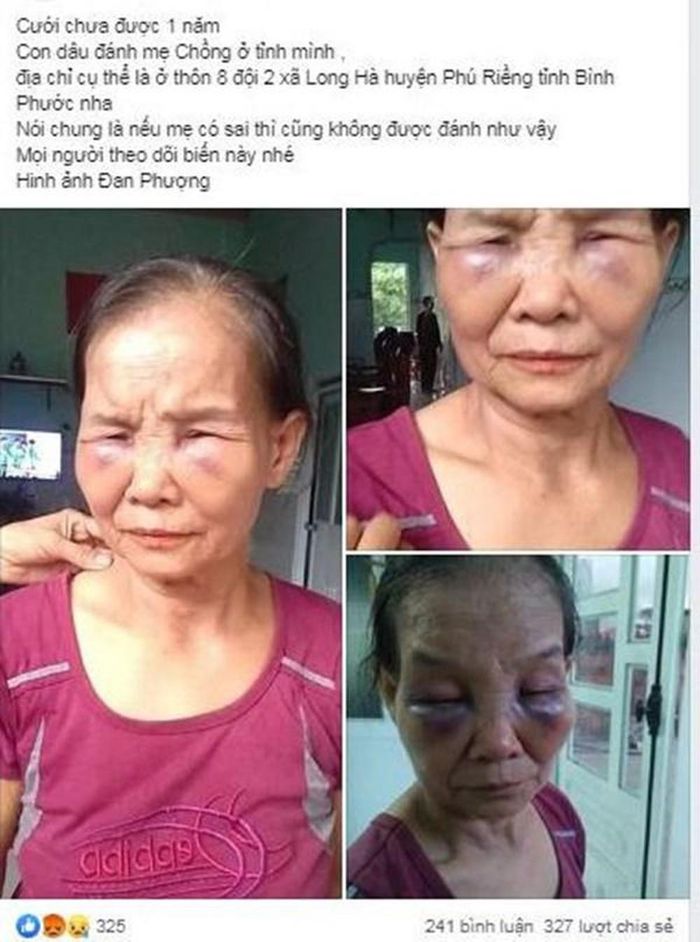 Bà Tạo cho hay: “Nó vào trong thấy rồi quay ra lớn tiếng nói lần sau còn để đây nữa là tôi hất vào phòng của bà. Bực mình quá, tôi với nó lời qua tiếng lại, rồi nó hỗn hào, đánh tôi từ phòng khách vào đến phòng trong. Nó đóng sập cửa lại ghì, kẹp người tôi, túm tóc đánh, đấm, đá tôi liên tục như kẻ thù. Thấy mặt tôi thâm tím, sưng to, nó ngồi xuống khóc xin lỗi bảo tôi đừng nói với ai”.