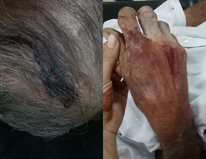 Hai ông bà trong đoạn clip trên đã ngoài 80 tuổi, đang sinh sống ở Tân Vĩnh Hiệp (Tân Uyên, Bình Dương). Ông bà bị chính con trai là Nguyễn Hoàng Minh (SN 1977, thất nghiệp ở nhà) hành hung. Bắt nguồn từ việc người này không đồng ý cho các chị gái kéo đường dây điện đi qua đất nhà mình nên xảy ra mâu thuẫn, mẹ già ra can ngăn thì bị con trai xông tới kiếm chuyện. 