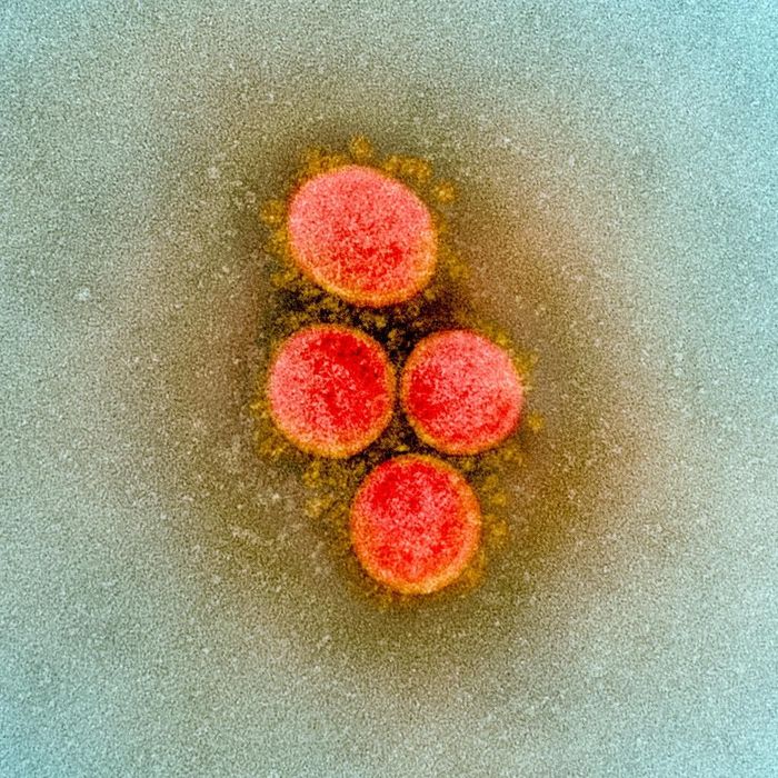  Bằng phương pháp này, chúng ta có thể nhìn thấy rõ đâu là phần "nhân" của virus, đâu là các gai protein chúng dùng để xâm nhập tế bào. Ảnh: NIAID. 