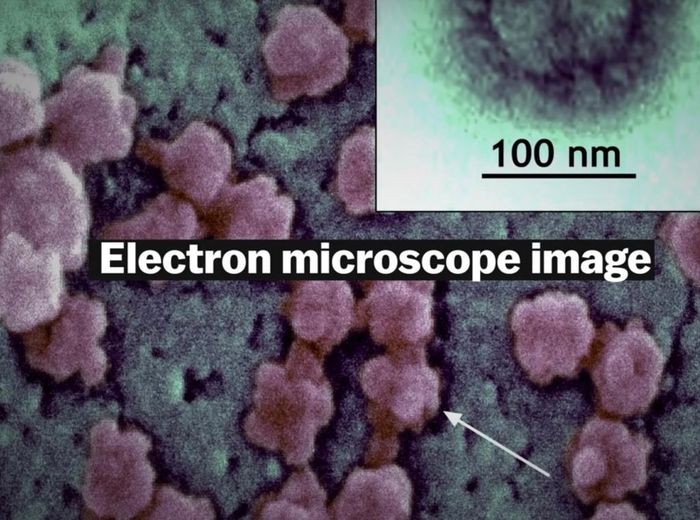  Để nhìn được virus corona, chúng ta phải dùng tới kính hiển vi điện tử. Loại kính hiển vi này sẽ phóng một dòng electron qua vật chất cần phóng đại. Ảnh: Vox. 