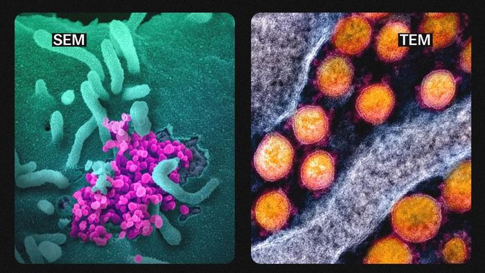  Kết hợp 2 hình thức, chúng ta có thể hiểu rõ hơn cách virus hoạt động. Lưu ý, mọi hình ảnh chụp lại dưới kính hiển vi điện tử đều là ảnh trắng đen, màu sắc được thêm vào sau đó để dễ nhận biết các vật trong hình. Ảnh: Vox. 