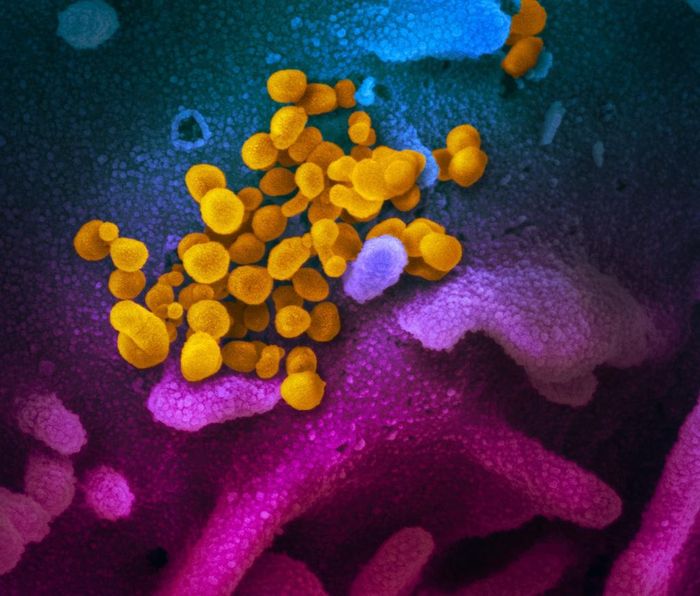  Trong bức ảnh này, có thể thấy những virus SARS-CoV-2 (màu da cam) thoát ra từ bề mặt tế bào (màu xanh và hồng). Hình ảnh này chi tiết và có thể nhìn rõ mức độ xa/gần của từng virus, cho thấy khoảng cách tương đối. Ảnh chụp từ kính hiển vi SEM nhìn rất thật, bởi phản xạ ánh sáng cũng là cách mắt người thu nhận hình ảnh ngoài đời. Ảnh: NIAID. 