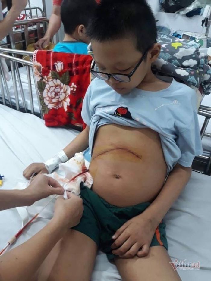 Nam Triều đã trải qua đợt mổ lấy khối u ở gan. Hiện tại con chỉ còn 3/4 lá gan, đã xơ giai đoạn 4.