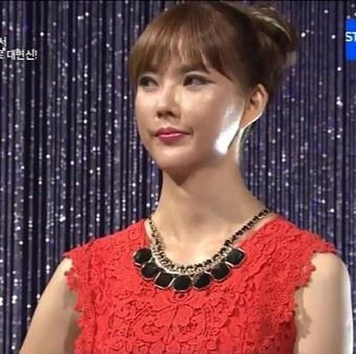 Kim Hyo Jeong là một trong những thí sinh nổi tiếng nhất chương trình Let's Beauty của Hàn Quốc. Cô được mệnh danh là người không cằm. Không những thế, Kim Hyo Jeong tự ti vì làn da xấu. Đi đâu cũng phải chịu đựng những lời đàm tiếu, chê bai. Ca phẫu thuật của cô còn bị đánh giá là khó. Chưa kể, để tiến hành phẫu thuật, bác sĩ phải lấy da ở nơi khác để đưa lên mặt bởi cô không có da cằm. Trải qua hành trình đầy đau đớn, Kim Hyo Jeong xuất hiện xinh đẹp trên truyền hình và gây choáng ngợp cho khán giả.