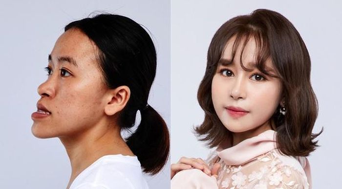  Mới đây, cô gái có tên Nguyễn Thị Thu Hà cũng có màn lột xác gây bất ngờ. Thu Hà bị hàm móm nên không thể cắn bất cứ thứ gì, kể cả thức ăn. Bên cạnh đó, cô gái đến từ Gia Lai bị hở hàm ếch nên phát âm không rõ ràng. Trước khi có được ngoại hình xinh đẹp hơn nhờ phẫu thuật thẩm mỹ, Thu Hà thường xuyên bị bạn bè, dư luận chê bai, đàm tiếu khiến cô gái tự tin, đau khổ. Qua chương trình truyền hình mới lên sóng, cô tiến hành nhiều cuộc phẫu thuật để chỉnh khớp hàm, gọt cằm, nâng mũi, cấy mỡ tự thân… để có ngoại hình như hiện tại. 