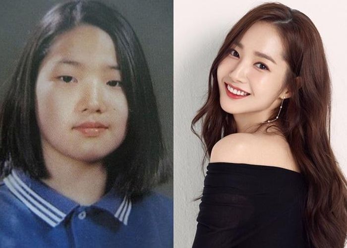  Không chỉ trên sóng truyền hình Việt Nam mà thế giới cũng có nhiều ca phẫu thuật thành công. Park Min Young - diễn viên nổi tiếng Hàn Quốc - cũng là trường hợp tiêu biểu lột xác bởi phẫu thuật thẩm mỹ. Hình ảnh nữ diễn viên có gương mặt bầu bĩnh, hai bên không cân xứng... từng gây xôn xao mạng xã hội kéo theo những lời bàn tán ác ý. Park Min Young trải qua nhiều cuộc phẫu thuật. So với hình ảnh trước khi ra mắt, ngôi sao Thư ký Kim sao thế? gần như trở thành người khác. Nữ diễn viên được nhận xét là một trong những ca chỉnh sửa thành công nhất Hàn Quốc. 