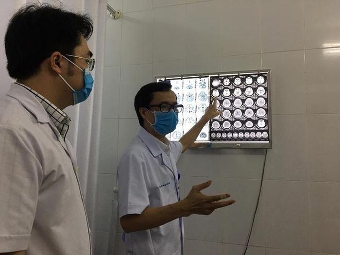  Theo PGS Hệ, triệu chứng của u não không đặc hiệu, vì thế, người bệnh thường chủ quan không đi khám. Ảnh: T.H. 