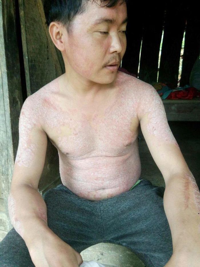 Hoàn cảnh đáng thương của gia đình anh Hà Văn Phượng đang rất cần được bạn đọc giúp đỡ