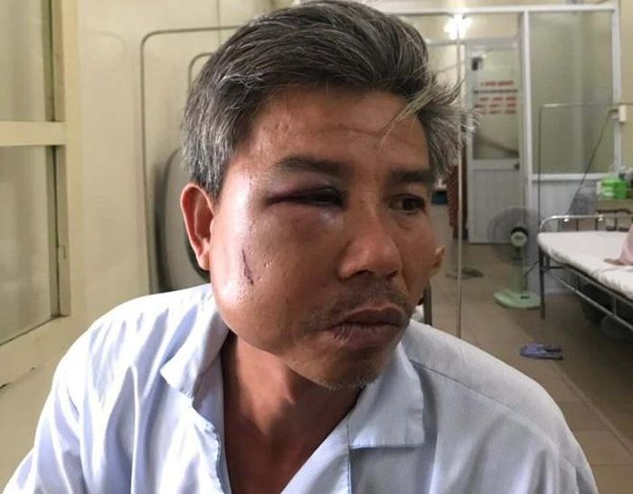 Ông Toàn bị đánh thương tích. Ảnh: N.V.