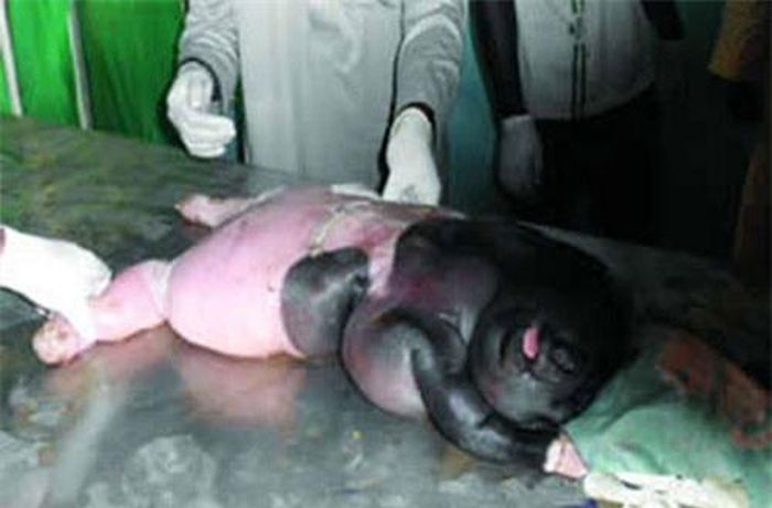 Các bác sĩ thú y tại Nigeria đã mổ giúp cừu mẹ sinh ra bào thai "nửa vật nửa người" này.