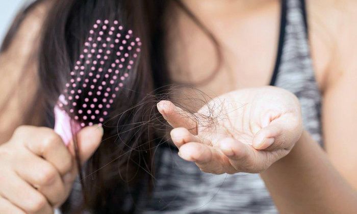 Rụng tóc do di truyền