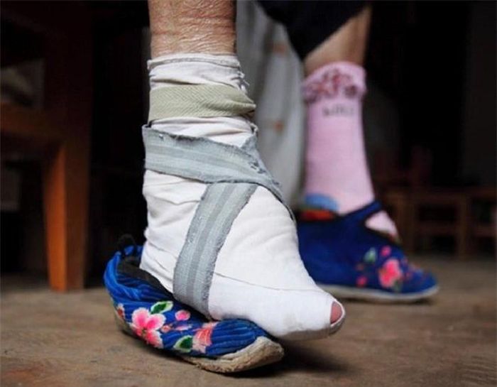 10. Bó chân: Chỉ khi có được đôi chân nhỏ nhắn, thon thả thì các thiếu nữ Trung Quốc mới mong lấy được chồng giàu sang. Trào lưu này thịnh hành gần 1.000 năm trước rồi bị hủy bỏ bởi tác hại lâu dài đối với sức khỏe. 
