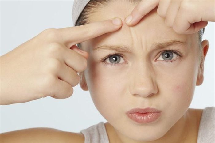 Mụn nhọt luôn là nỗi ám ảnh của các cô gái. Ngoài làm mất thẩm mỹ, nó gây đau rát, khó chịu. Do đó, bạn cần biết cách chăm sóc và điều trị hợp lý tránh khiến tình trạng này trở nên trầm trọng hơn, thậm chí để lại sẹo vĩnh viễn. Ảnh:sohu.