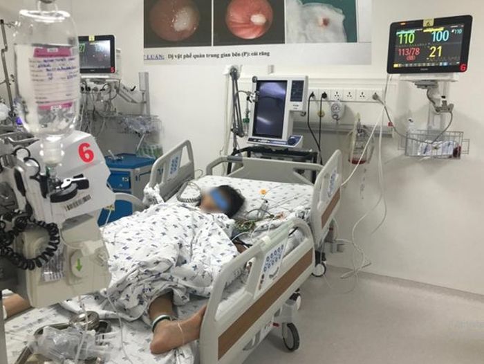 Bệnh nhi đang được điều trị tại BV Nhi đồng thành phố